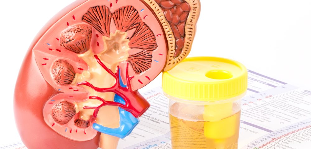 Alport Syndrome Seen Early Helps Prevent End-Stage Kidney Disease