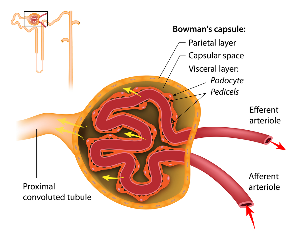 kidney cells called podocytes