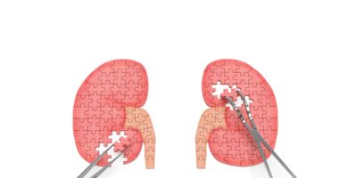 kidney health in US